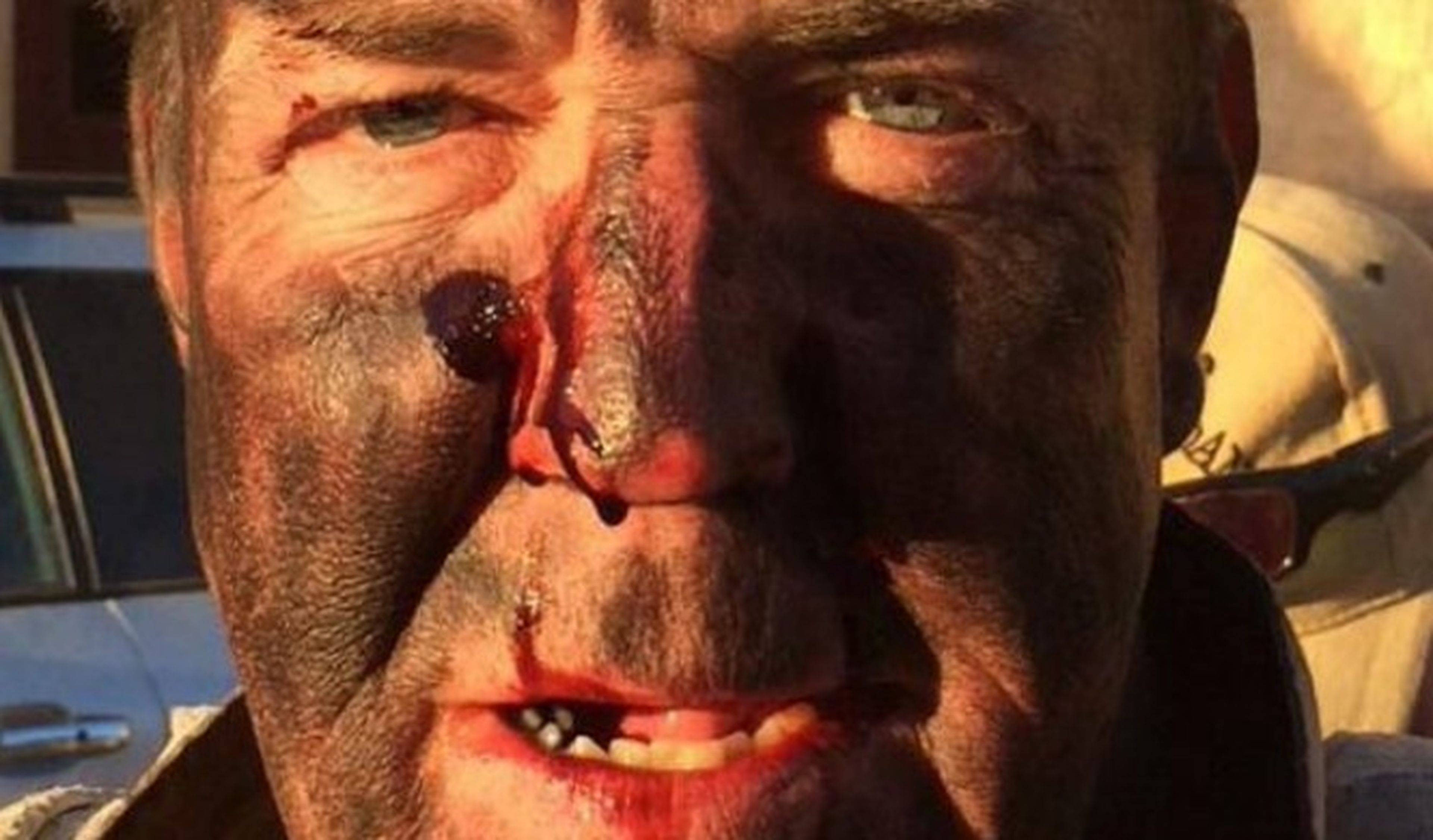 ¿Qué le ha pasado a Jeremy Clarkson en la cara?