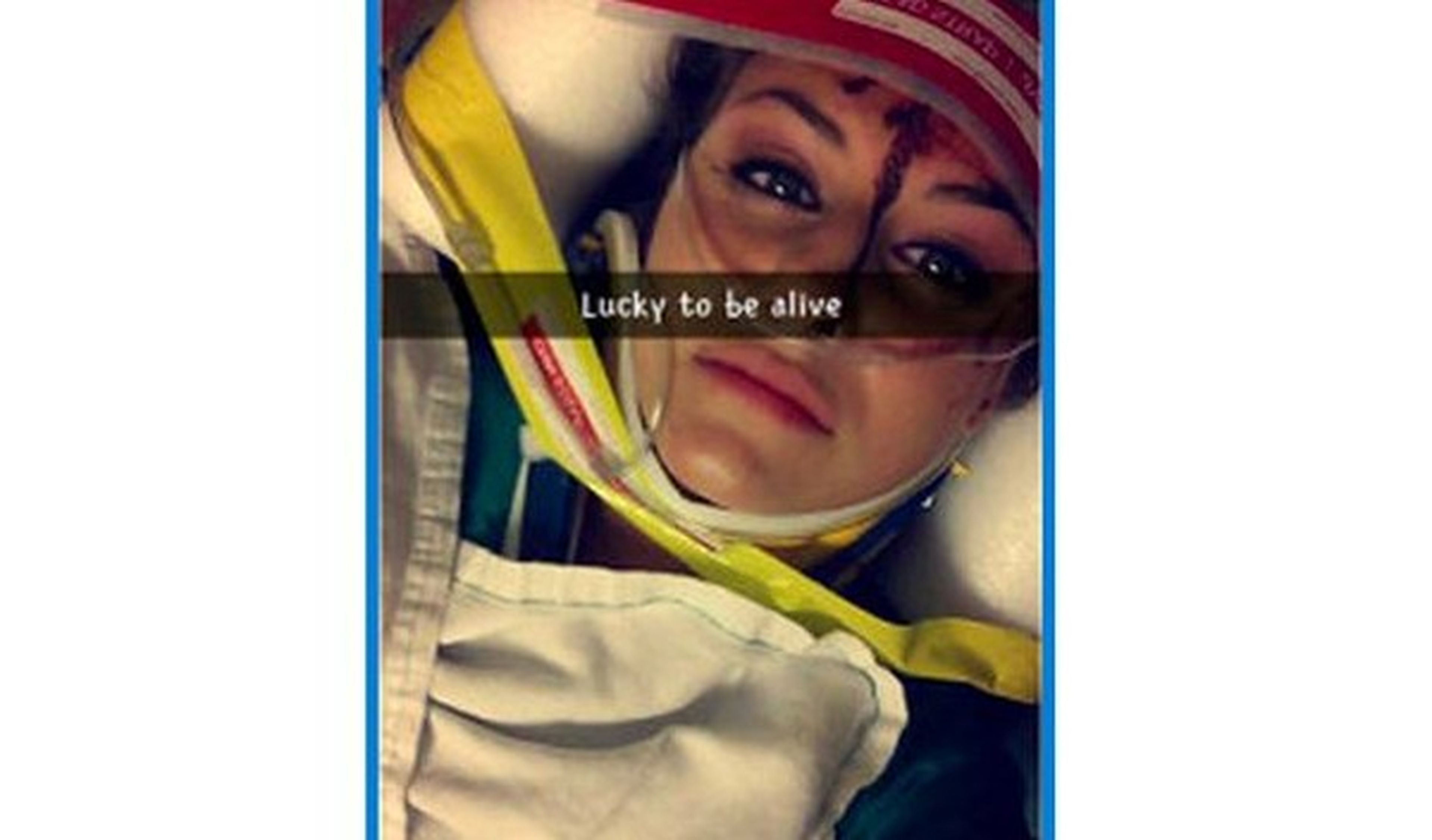 ¡De locos! Sigue usando 'snapchat' tras sufrir un accidente