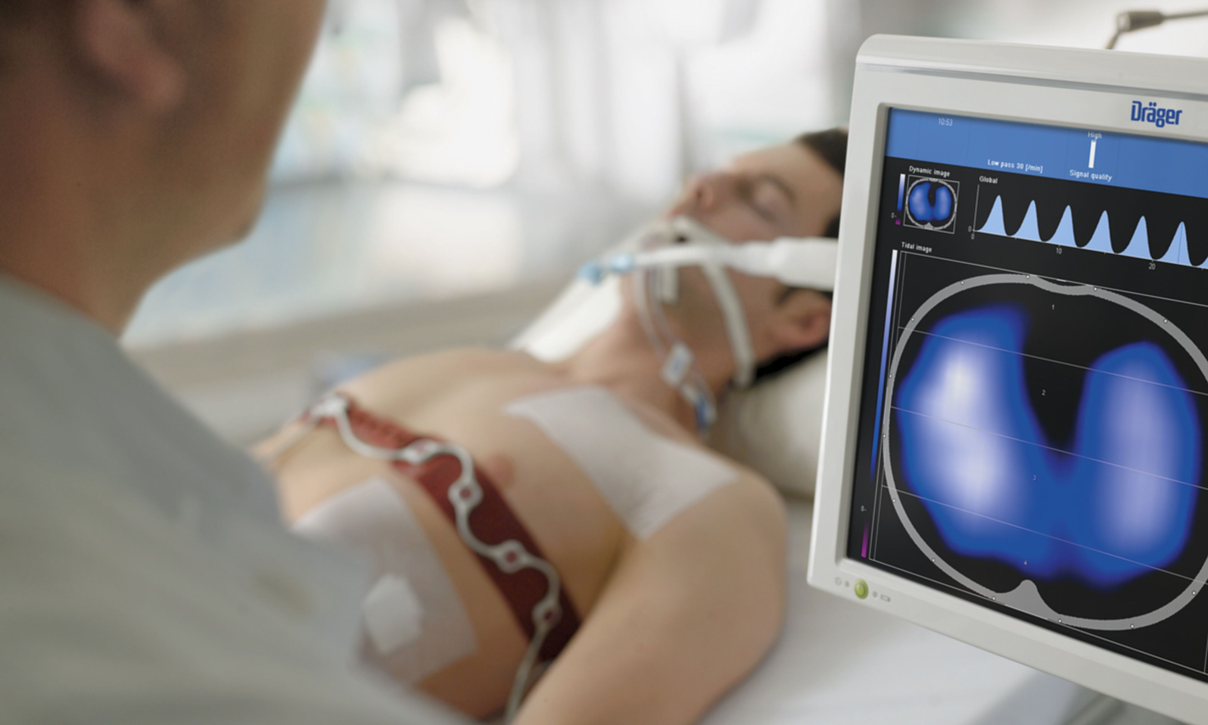 Dräger ha recibido un pedido de 10.000 máquinas de respiración asistida.