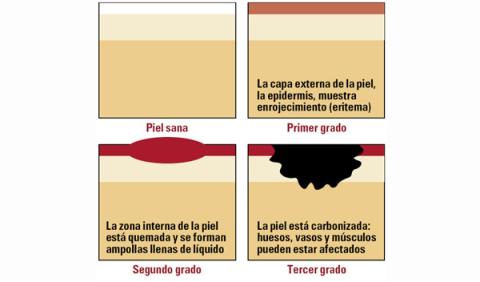 Cómo actuar ante un accidente de tráfico: Primeros auxilios